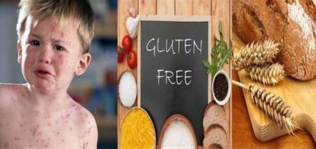 Gluten Alerjisi ve Alternatif Beslenme